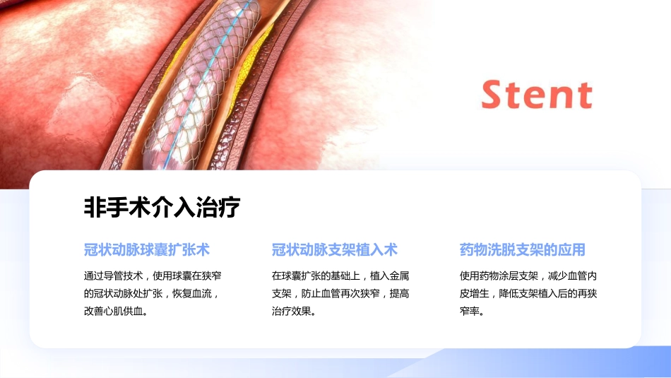 冠心病的一病一品_第14页