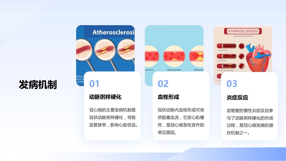 冠心病的一病一品_第5页