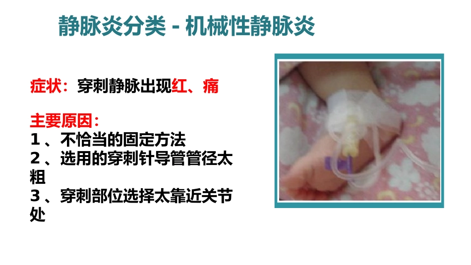 静脉炎的预防及护理ppt_第11页