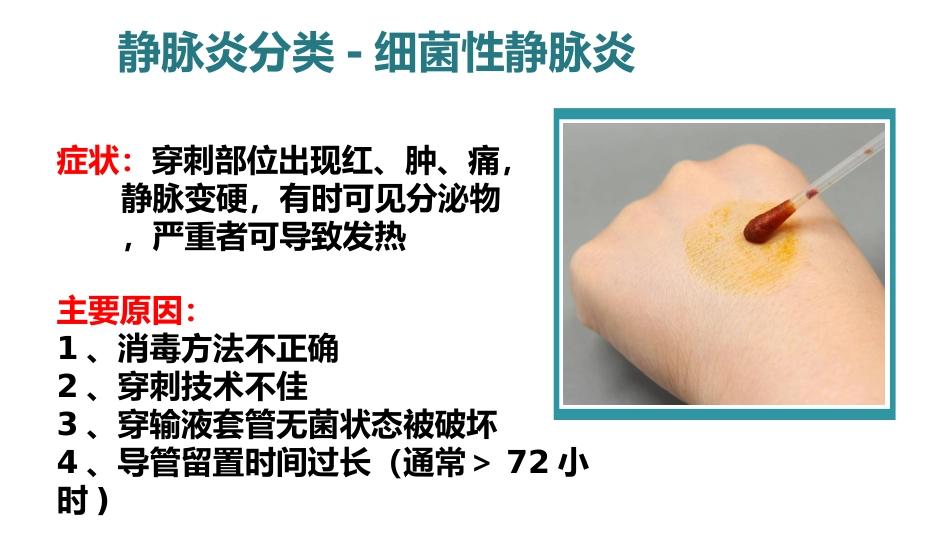 静脉炎的预防及护理ppt_第13页