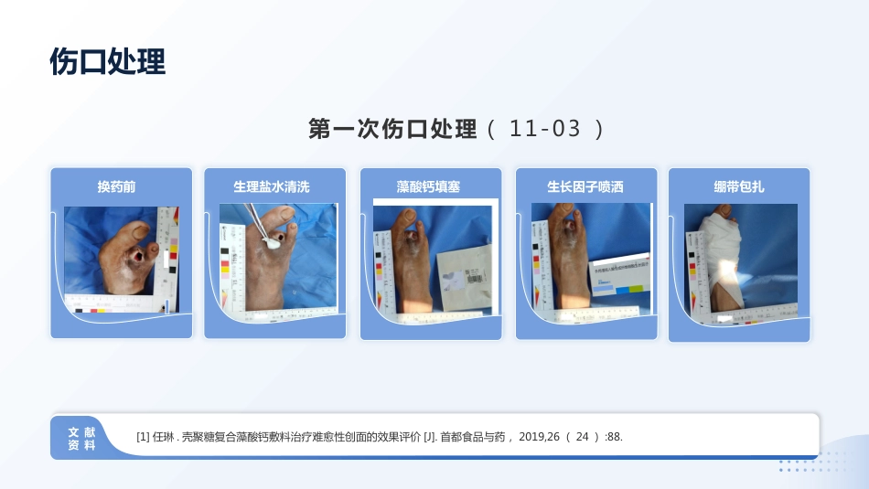 MDT模式下1例Wagner3级糖尿病足患者截趾术后的伤口护理_第12页