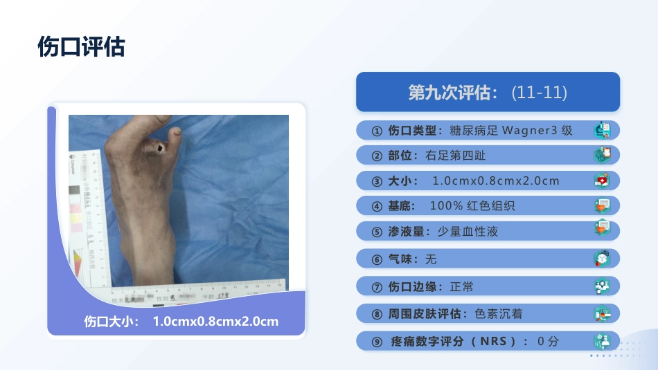 MDT模式下1例Wagner3级糖尿病足患者截趾术后的伤口护理_第13页