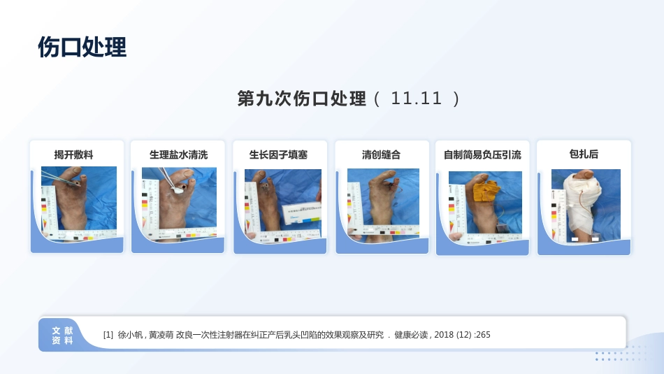MDT模式下1例Wagner3级糖尿病足患者截趾术后的伤口护理_第14页
