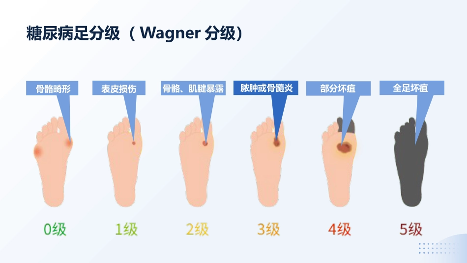 MDT模式下1例Wagner3级糖尿病足患者截趾术后的伤口护理_第4页