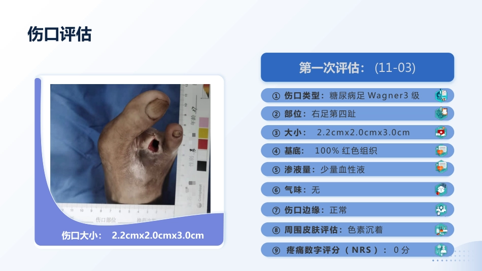 MDT模式下1例Wagner3级糖尿病足患者截趾术后的伤口护理_第8页