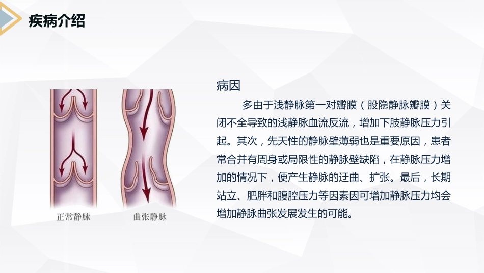 外科护理：下肢静脉曲张的护理查房_第6页