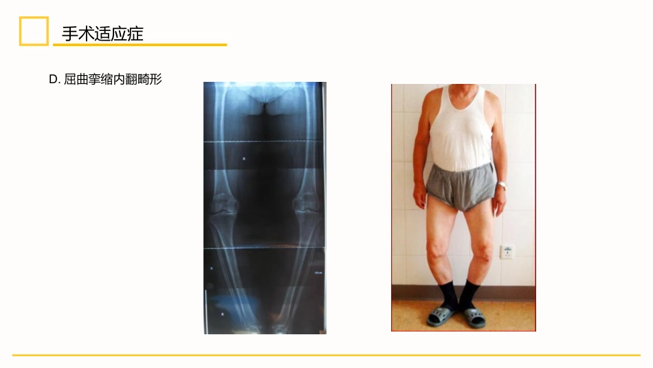 外科护理：膝关节置换术后护理_第7页