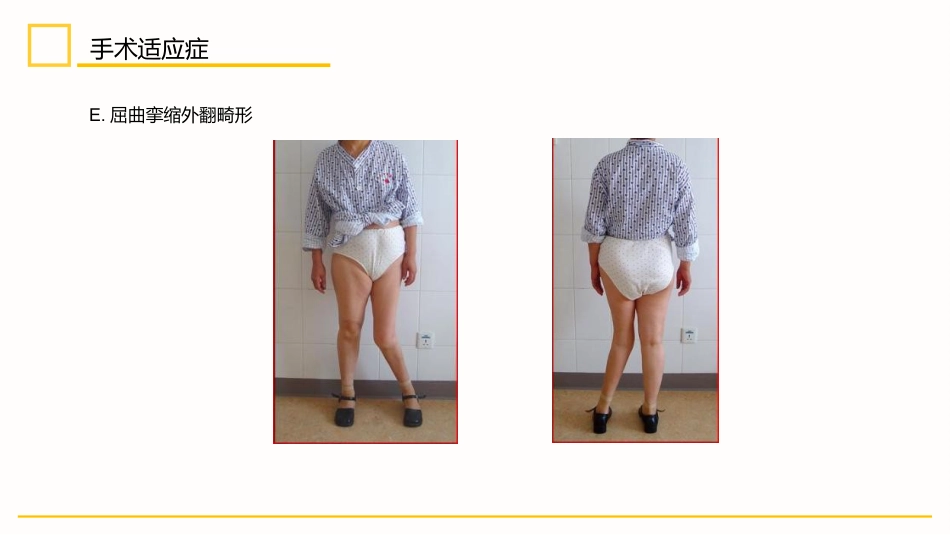 外科护理：膝关节置换术后护理_第8页