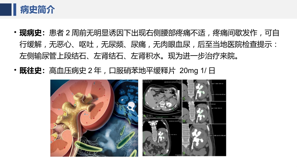 经皮肾镜碎石术后护理课件_第15页
