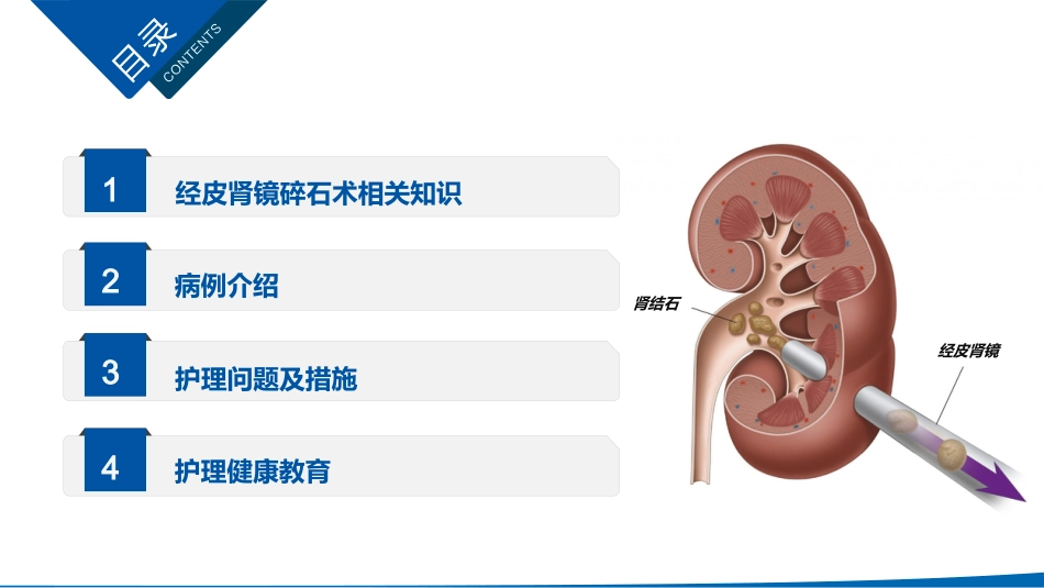 经皮肾镜碎石术后护理课件_第2页