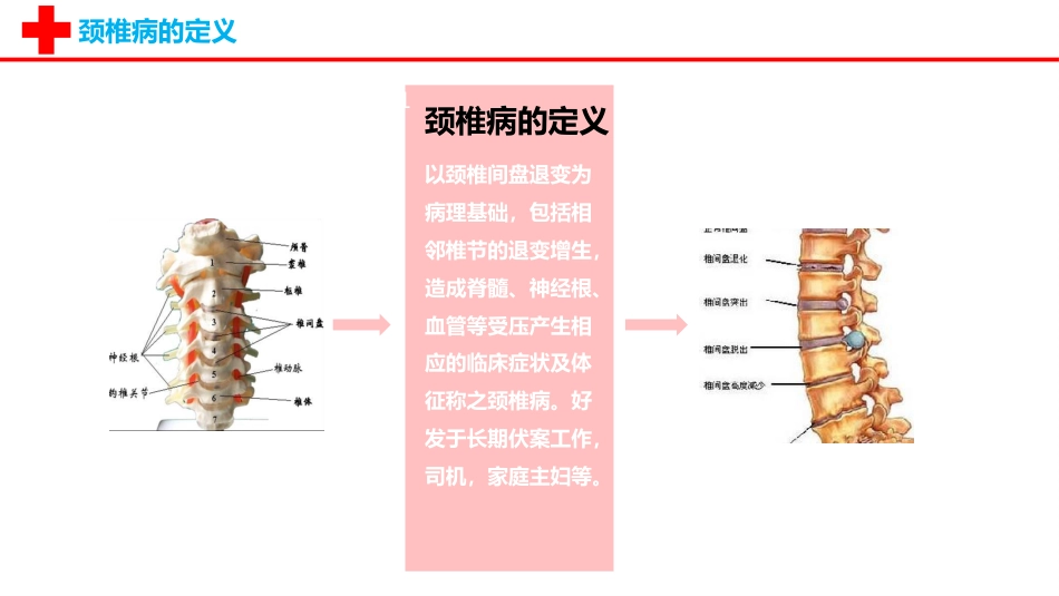 外科护理：颈椎病护理查房PPT_第3页