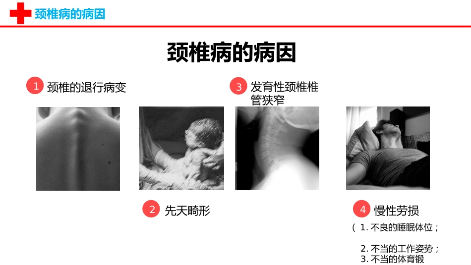 外科护理：颈椎病护理查房PPT_第4页