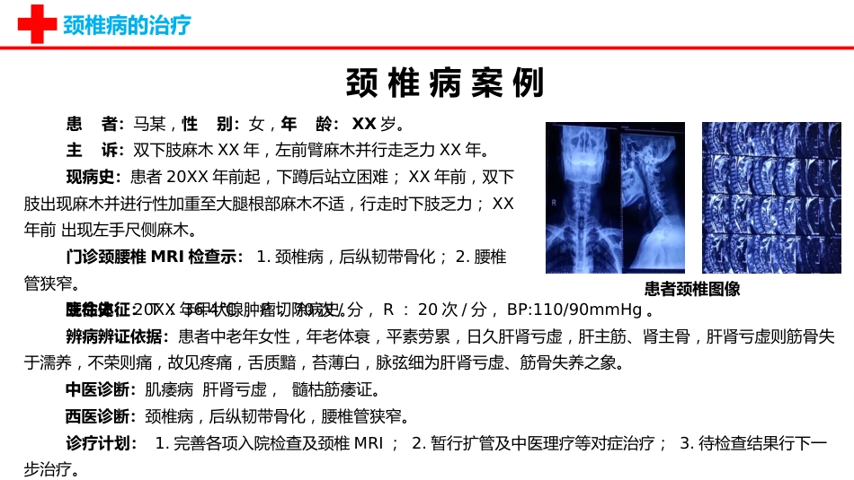 外科护理：颈椎病护理查房PPT_第9页