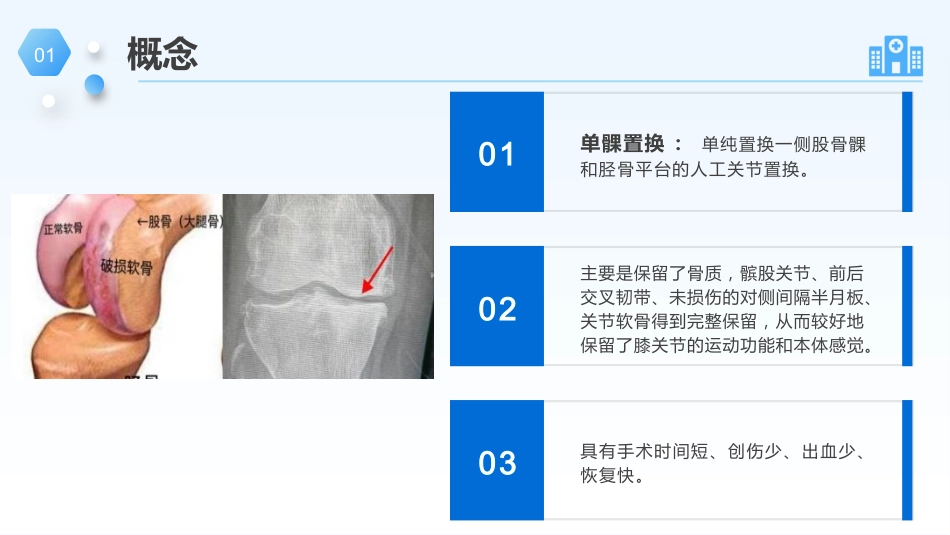 膝关节单髁置换手术的护理个案_第4页