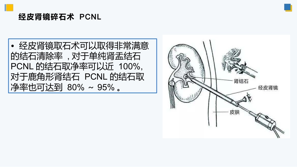 经皮肾镜碎石术后护理_第13页