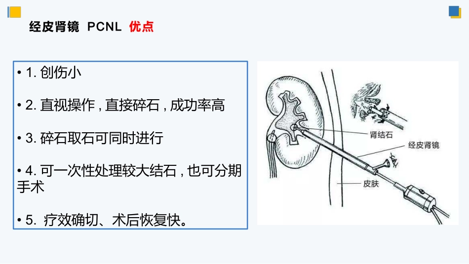 经皮肾镜碎石术后护理_第14页