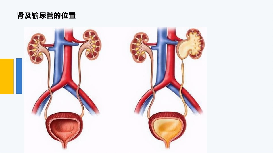 经皮肾镜碎石术后护理_第5页