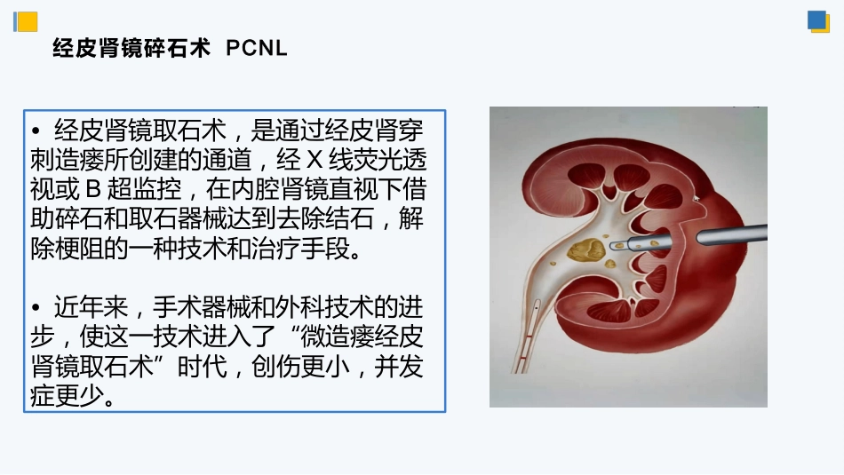 经皮肾镜碎石术后护理_第9页