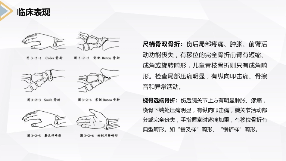 外科护理：左桡尺骨双骨折的护理查房_第10页