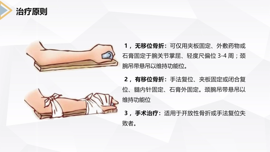 外科护理：左桡尺骨双骨折的护理查房_第13页