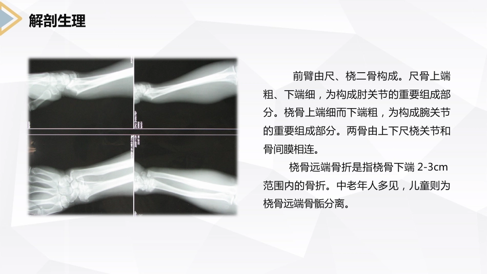 外科护理：左桡尺骨双骨折的护理查房_第8页