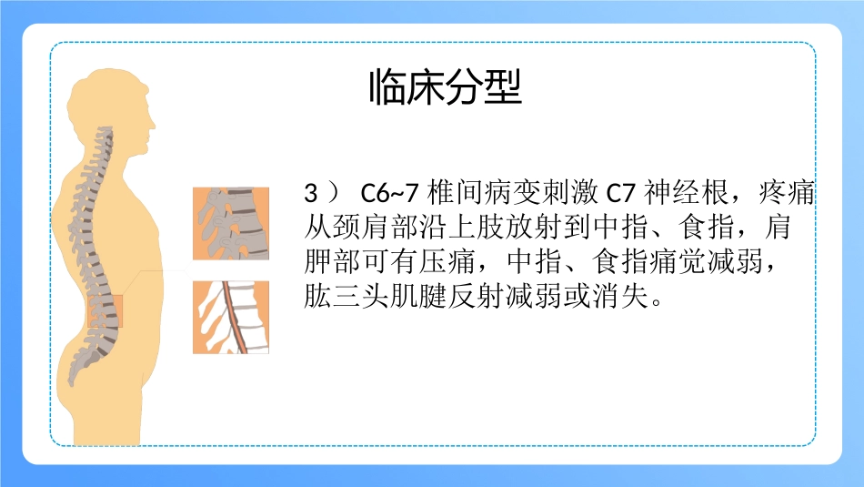 外科护理：颈椎病病人的护理_第10页