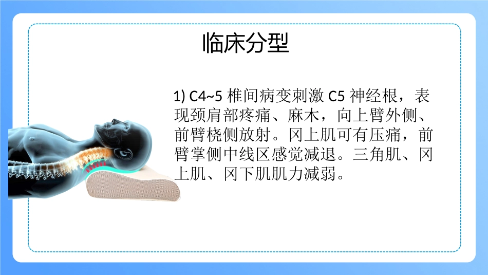 外科护理：颈椎病病人的护理_第8页