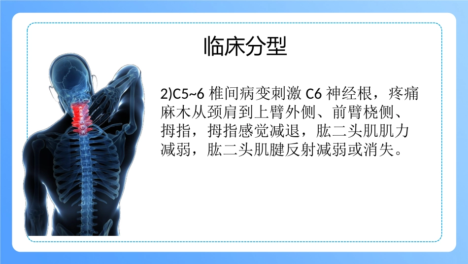 外科护理：颈椎病病人的护理_第9页