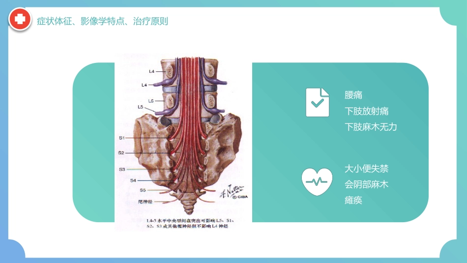 外科护理：腰椎间盘突出症围手术期护理及康复锻炼_第12页