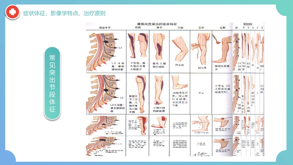 外科护理：腰椎间盘突出症围手术期护理及康复锻炼_第14页