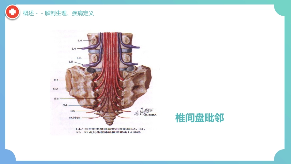 外科护理：腰椎间盘突出症围手术期护理及康复锻炼_第6页
