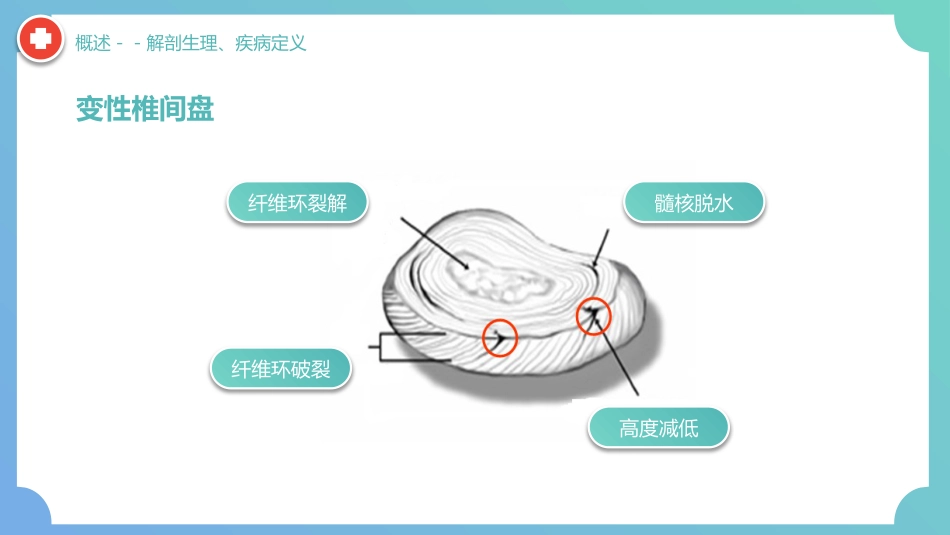 外科护理：腰椎间盘突出症围手术期护理及康复锻炼_第9页