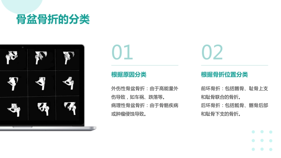 骨盆骨折的护理ppt课件_第5页