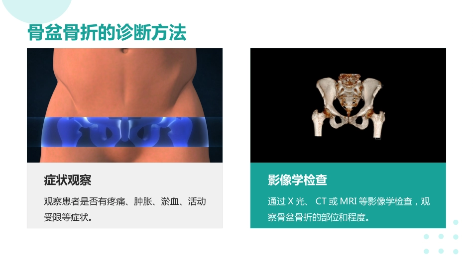 骨盆骨折的护理ppt课件_第9页
