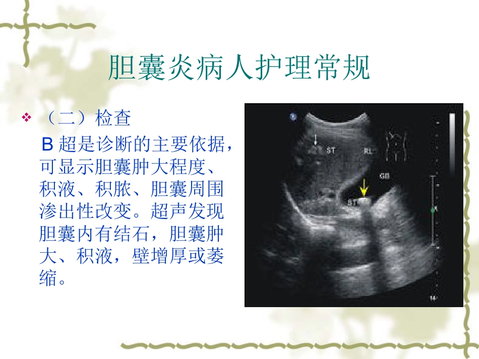 胆囊炎病人护理常_第7页