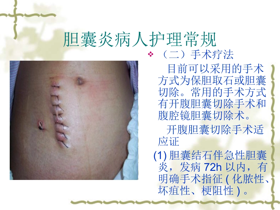 胆囊炎病人护理常_第9页