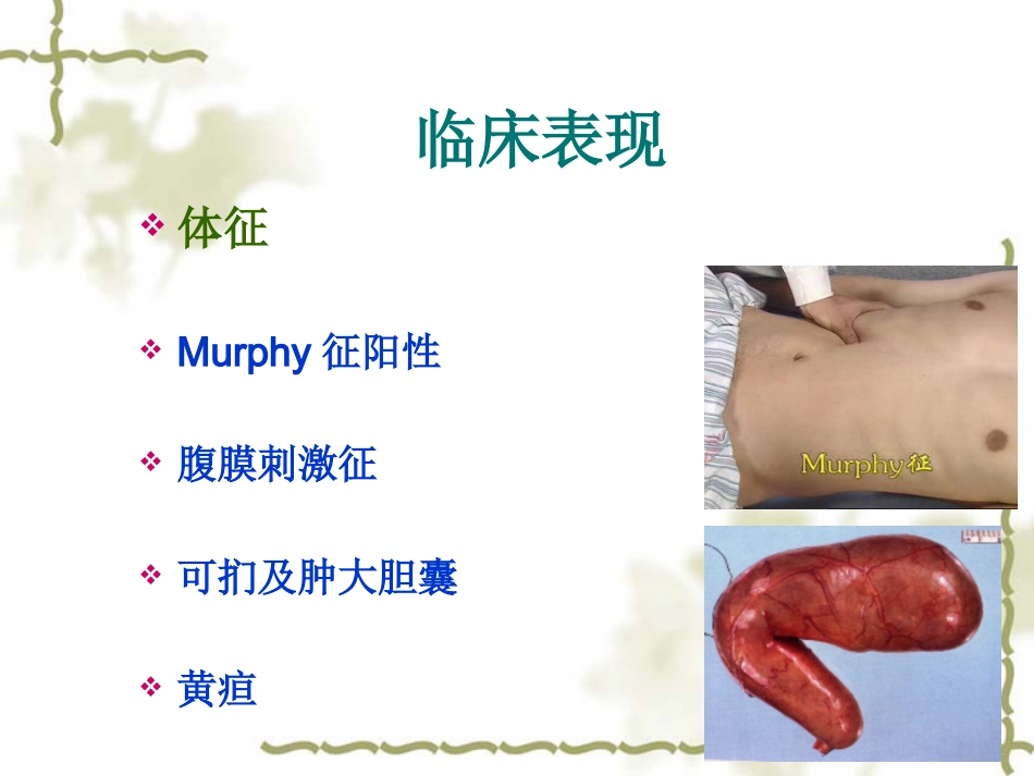 胆囊炎病人护理常-PPT_第11页