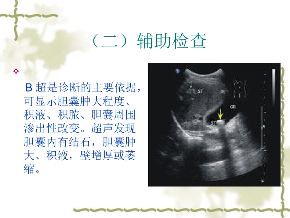 胆囊炎病人护理常-PPT_第15页