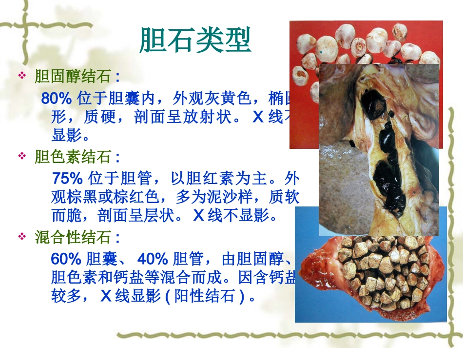 胆囊炎病人护理常-PPT_第6页
