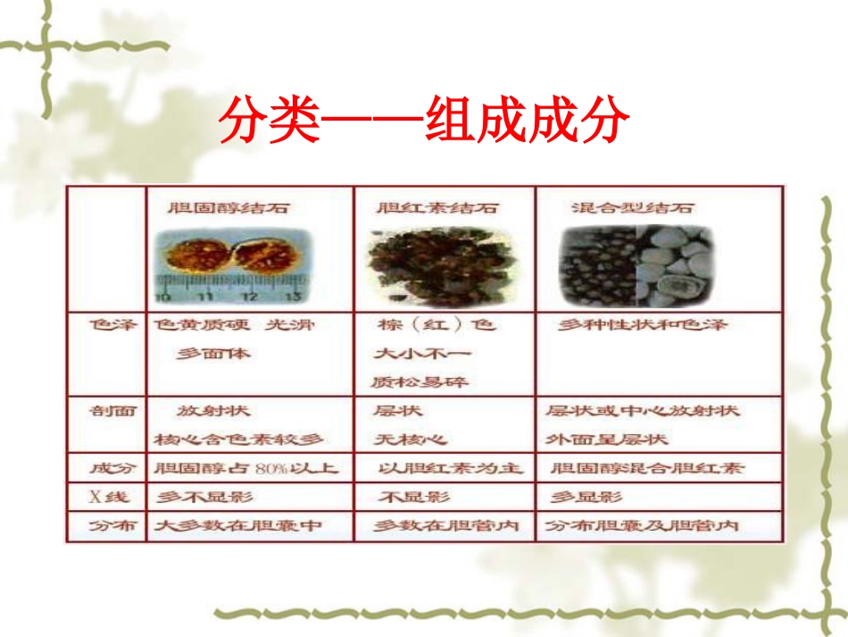 胆囊炎病人护理常-PPT_第7页