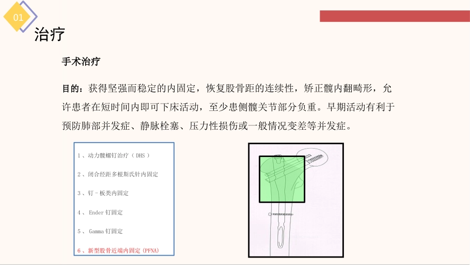 股骨粗隆间骨折的护理查房_第13页