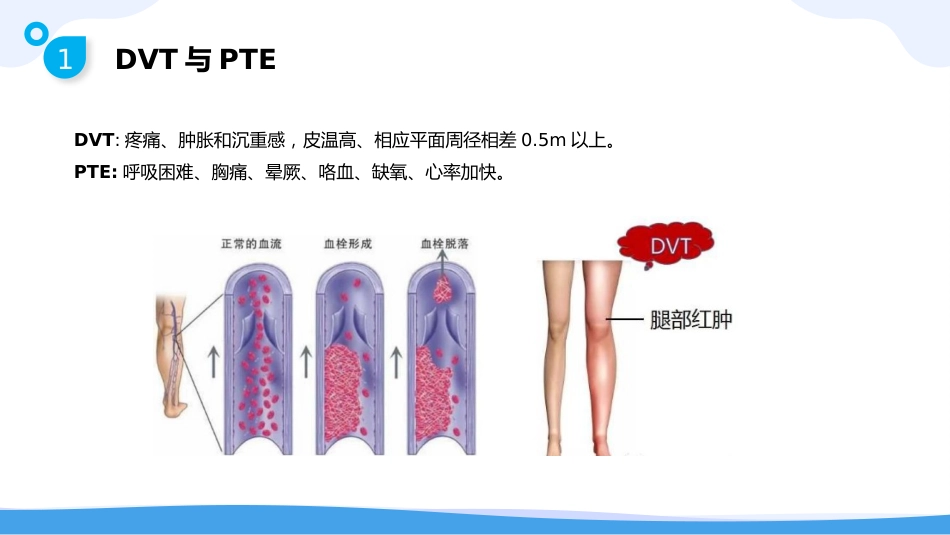 静脉血栓栓塞症(VTE)的-预防与护理_第6页