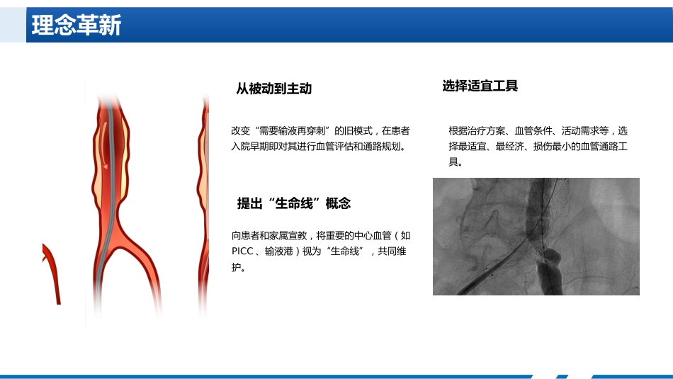 静脉治疗新进展与特殊情况护理_第13页