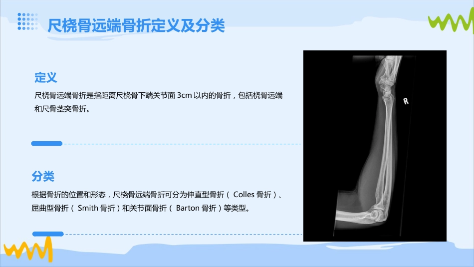 尺桡骨远端骨折的护理_第4页