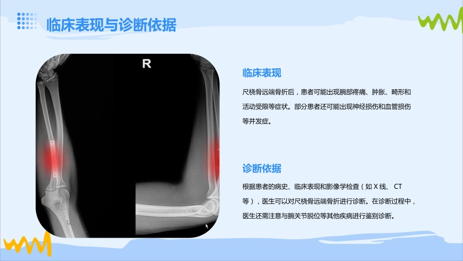 尺桡骨远端骨折的护理_第6页