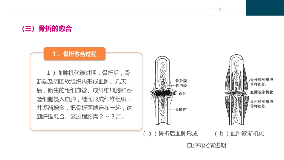 骨与关节疾病病人的护理_第14页