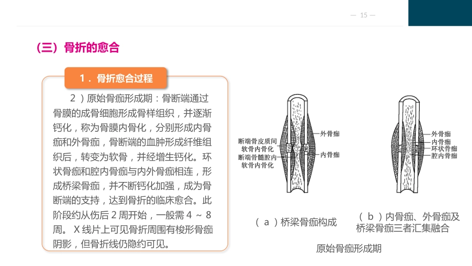 骨与关节疾病病人的护理_第15页