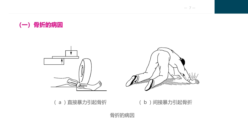 骨与关节疾病病人的护理_第7页