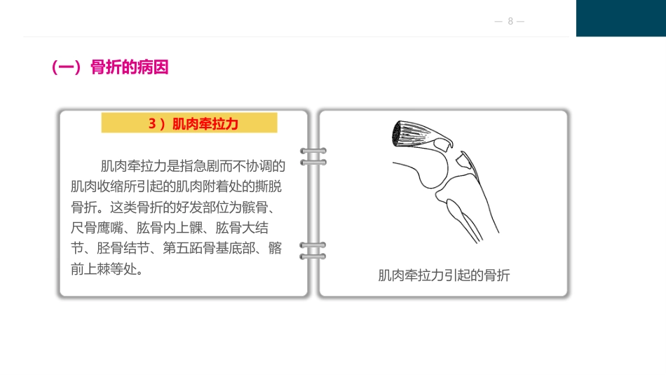 骨与关节疾病病人的护理_第8页