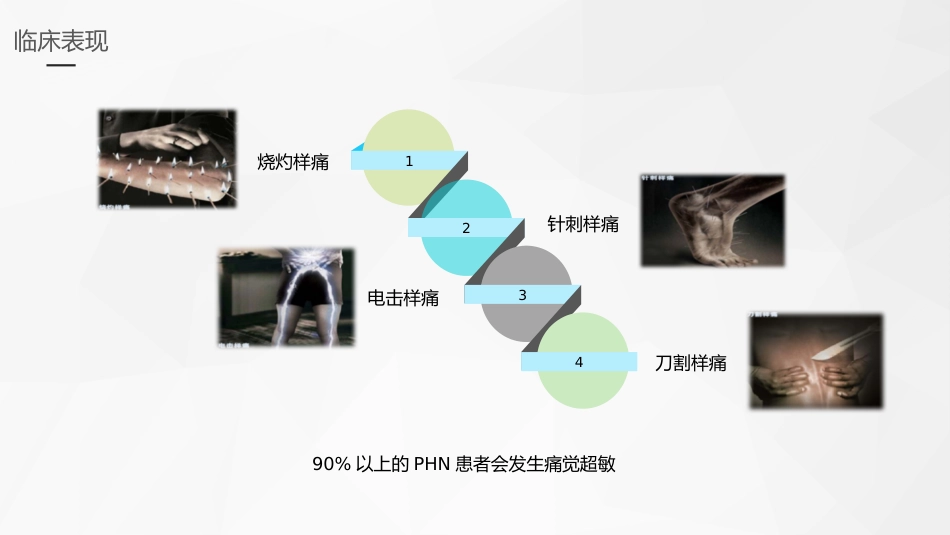 外科护理：带状疱疹后遗神经痛护理_第12页